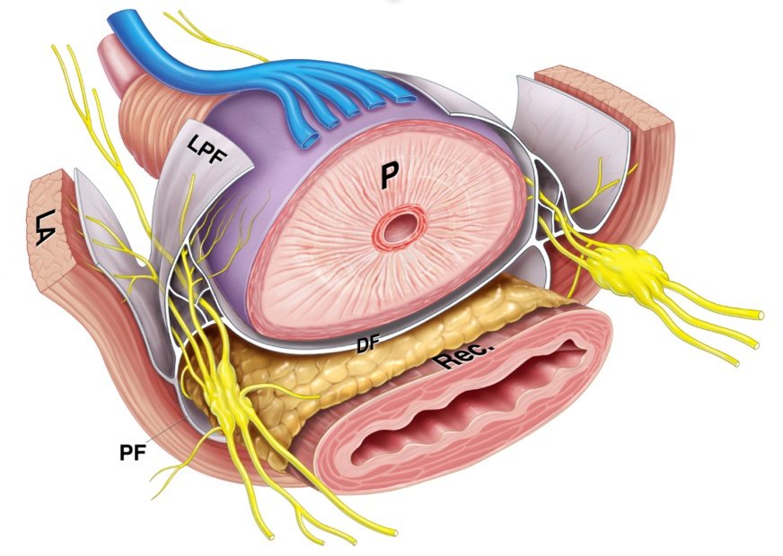 Como preservar a ereção na cirurgia da próstata